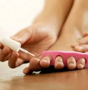 Aplikace terapeutického laku